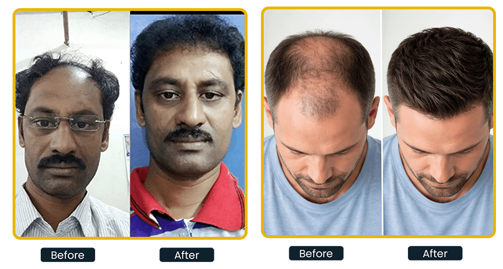 Mobile Result 1